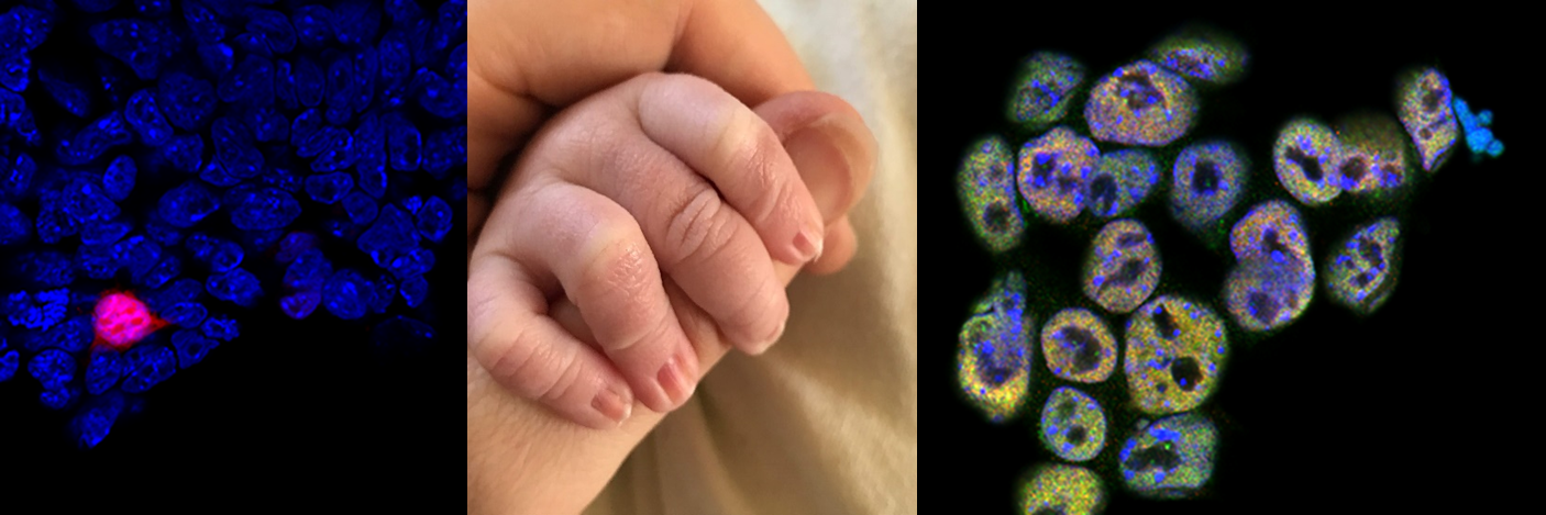 A picture of Melanie's cell work and her baby's hand