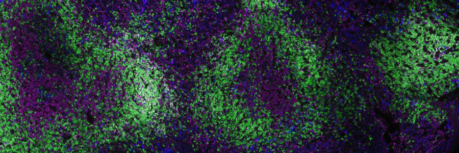 Exploring the effects of age on the immune response to Oxford’s COVID-19 vaccine