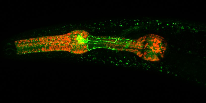 An image showing the pharynx of the model organism C. elegans with fluorescently tagged proteins ; SCAV-3 (GFP) and RHO-1 (RFP). SCAV-3 helps maintain the membrane integrity of lysosomes (represented by the green circles around the pharynx), a vital organelle responsible for protein degradation. Here, we're trying to detect the co-localisation of the lysosomes and RHO-1, a globular protein prone to aggregate with age. The large green structure in the middle represents a neuron.