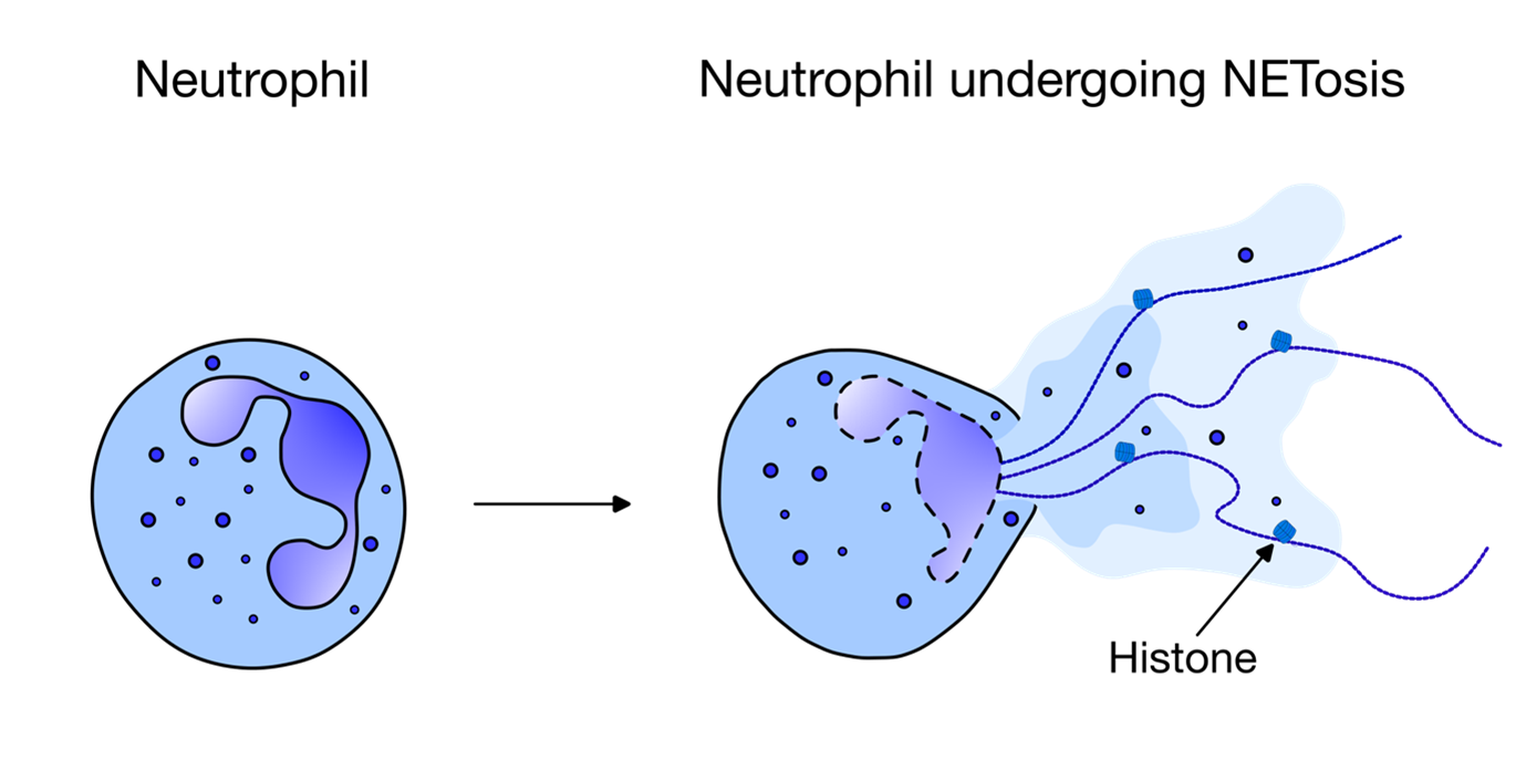 NETosis diagram