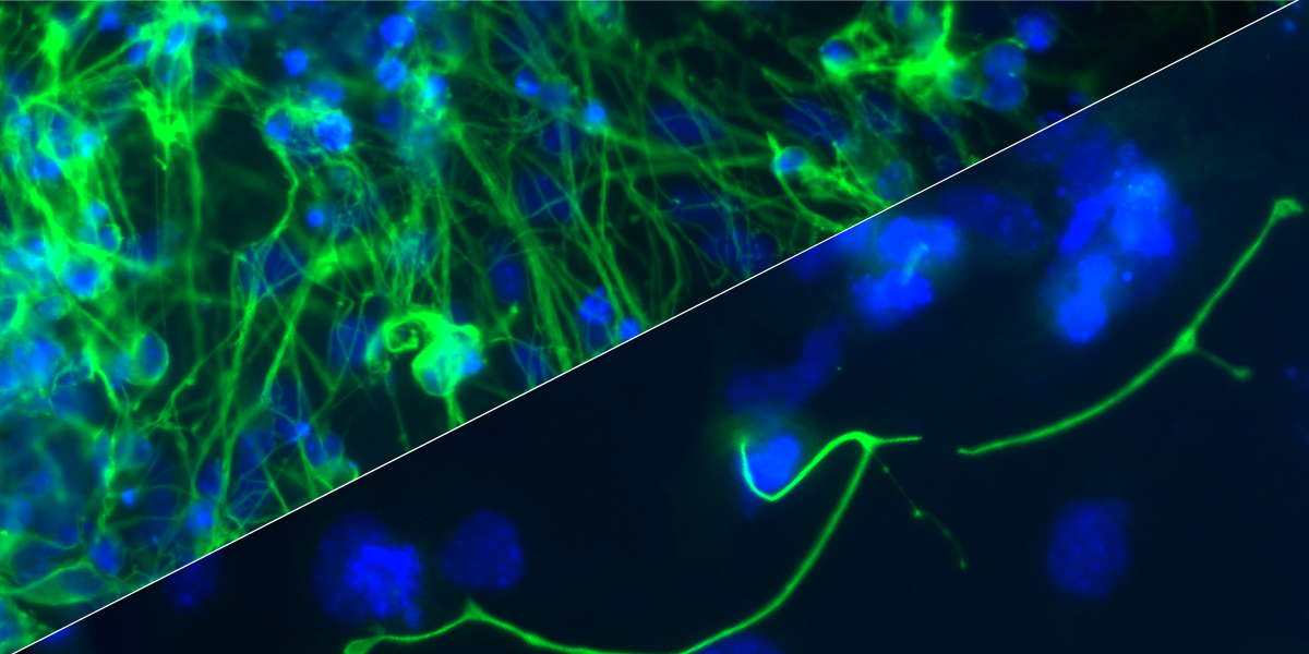 Repressed but ready to go: how intricate molecular interactions establish responsiveness to gene expression cues that shape development