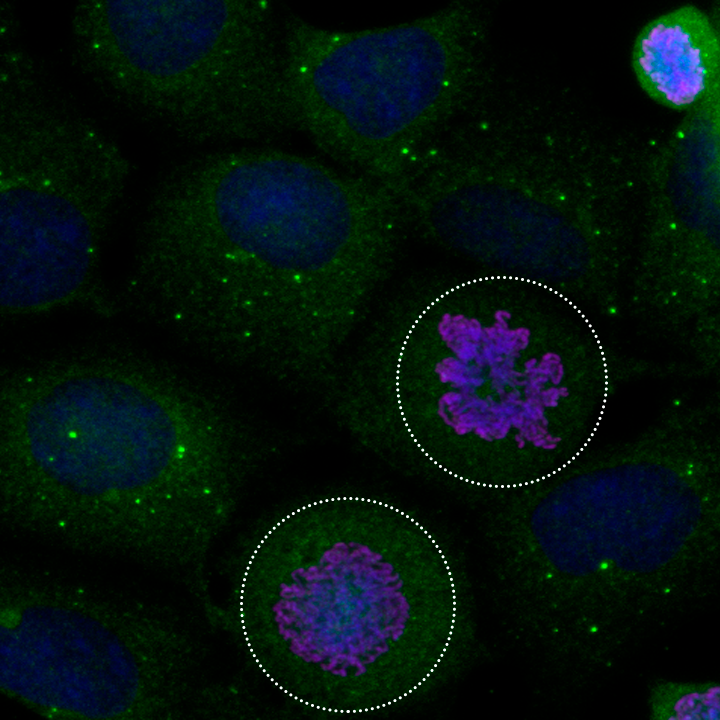 HeLa cells stained with fluorescent markers, highlighting cells undergoing division