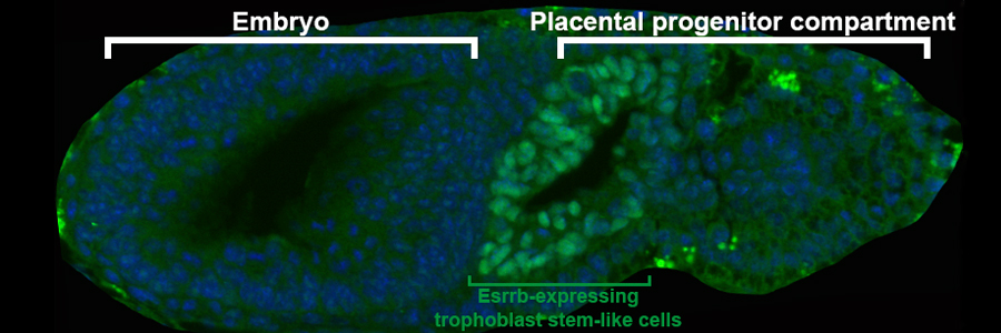 Understanding the networks that regulate trophoblast stem cell renewal