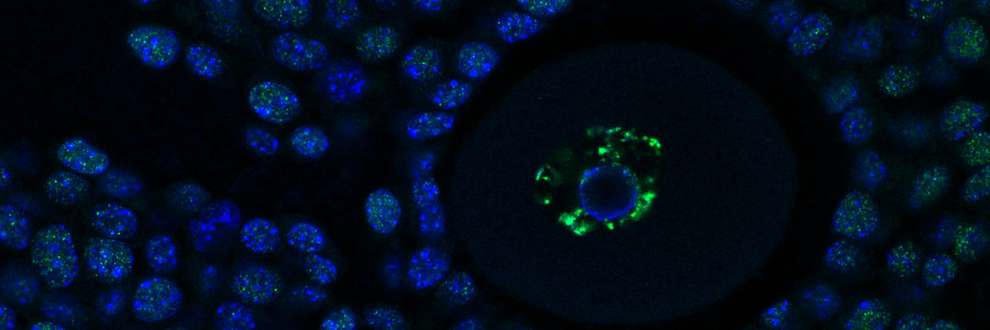 Keeping egg cells fresh with epigenetics