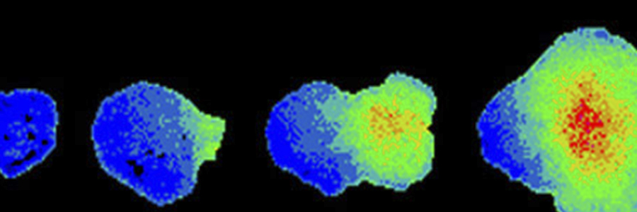 Babraham Institute develops new way of seeing signalling molecules at work