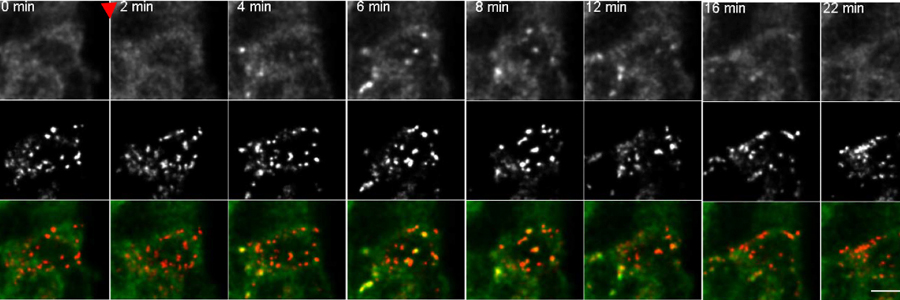Real-time imaging uncovers mTORC1 dynamics